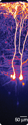 An image taken in Simon Schultz’s lab: two-photon imaging of layer-five pyramidal cells in a living mouse brain. (Image courtesy of Simon Schultz.)