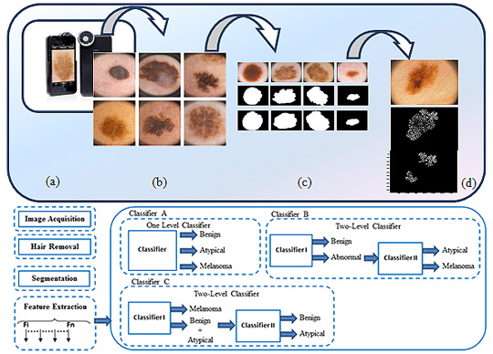 Noninvasive Real-Time Automated Skin Lesion Analysis System for Melanoma Early Detection and Prevention