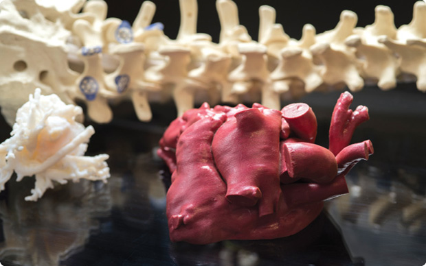 Pediatric cardiac surgeons can print a three-dimensional model of a child’s organ (a heart for example) from any clinically acquired digital image to reveal structural abnormalities before they perform an operation. (Photo by Kaveh Sardari, courtesy of Children’s national Health System.)