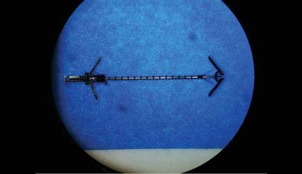 A metal MEMS tissue approximation device. It is fabricated fully assembled, and the two pairs of spring-loaded wings fold in so that the device can be delivered through a 1.6-mm lumen of a robotic catheter. The teeth in the middle are part of a ratcheting mechanism allowing precise adjustment of the distance between the pairs of wings. (Photo courtesy of Pierre Dupont.)