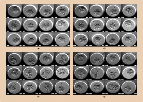 (a)–(d) Developmental scenes from an EmbryoScope caught at various stages and time intervals in Nina Desai's lab in Cleveland, Ohio. (Images courtesy of the Cleveland Clinic IVF Laboratory.)