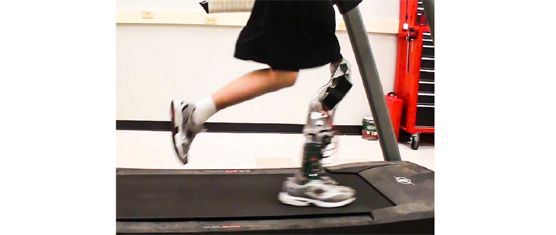 Running With a Powered Knee and Ankle Prosthesis