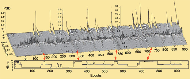FIGURE 3 - An example of the continuous spectral analysis of the HRV signal at night. The time is expressed in 30-second epochs. The REM periods, marked by the red arrows, are clearly visible on the sequence of the power spectra. PSD: power spectral density; Hipno: hypnogram.