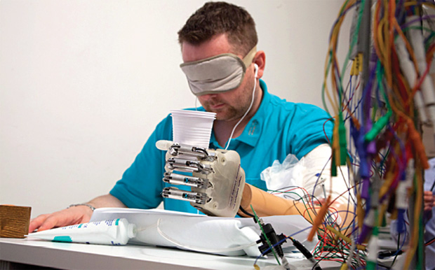 FIGURE 7 - The experimental setup for validating a bionic prosthesis on a human amputee [9].