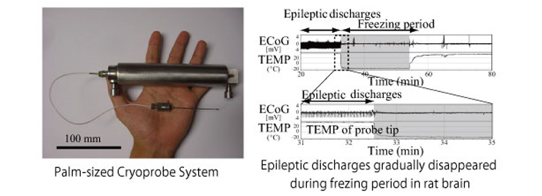 The Palm-Sized Cryoprobe System Based on Refrigerant Expansion and Boiling and its Application to an Animal Model of Epilepsy