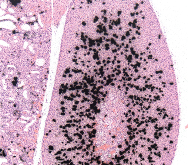 Figure 4 - p5+14 in an adrenal gland section from a mouse model of amyloidosis. (Image courtesy of the Actp, University of Tennessee Medical Center.)