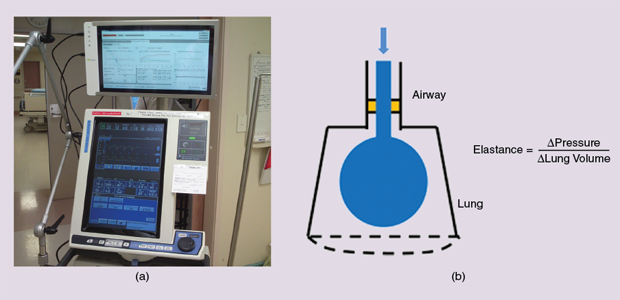 FIGURE 1 (a) CURE Soft (top screen) with a ventilator in Christchurch Hospital and (b) the lung model used to guide MV, where the goal is maximum lung volume for minimum pressure to minimize patient-specific, model-based lung elastance.