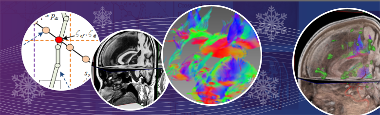 Multimodality Neurological Data Visualization with Multi-VOI Based DTI Fiber Dynamic Integration