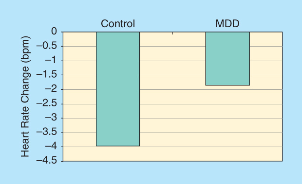 FIGURE 4: Heart rate change for control and MDD participants.