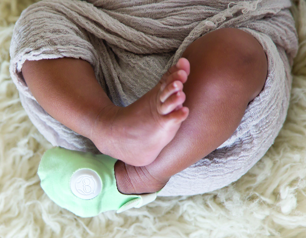 FIGURE 5: The Owlet sock. (Photo courtesy of Owlet Baby Care.)