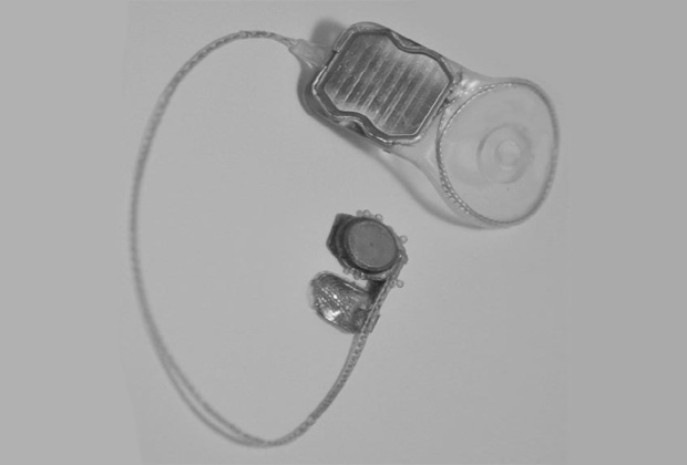 Figure 1. A functioning Phoenix99 implant system showing the electronics and wireless coil (top) for transfer of data and power and the intra-ocular components of electrode array and stimulating electronics (bottom) joined by a charge-neutral, two-wire interface.