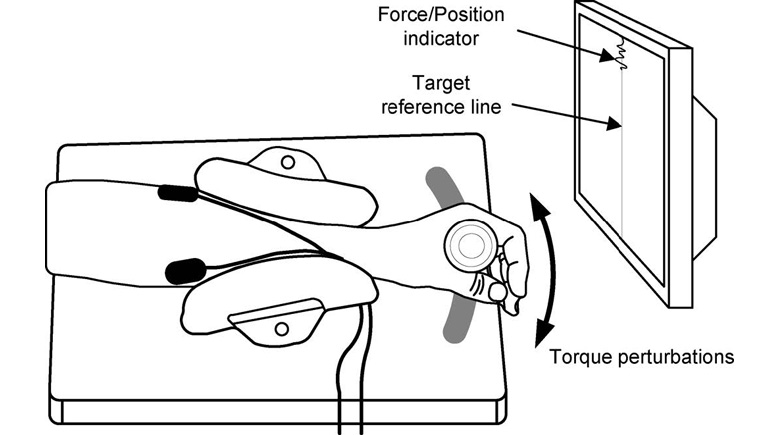 Impaired Inhibitory Force Feedback in Fixed Dystonia