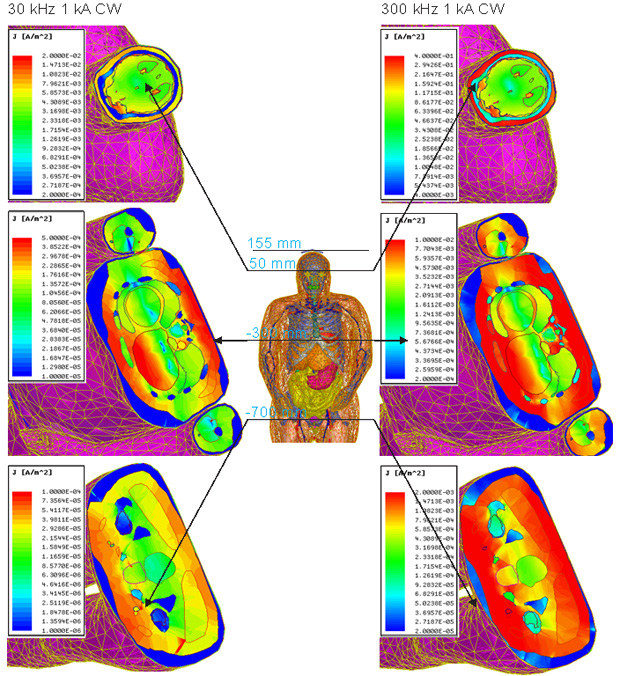 Figure 4: Current densities induced by TMS at various locations using the VHP-Female model.