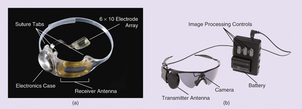Figure 6: Second Sight’s Argus II Retinal Prosthesis System consists of (a) a retinal implant and (b) a glasses-mounted camera that sends an image to a computer, which processes the information and transmits it wirelessly to the implant. The implant relays the information to retinal cells, and the information ultimately passes along to the brain. (Photo courtesy of Second Sight Medical Products, Inc.)