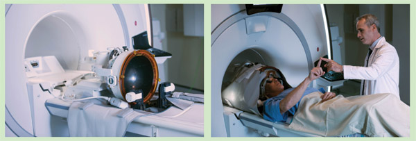 Figure S3: InSightec is developing its ExAblate system to use a specially designed helmet attached to the bed of an MRI scanner. In this system, a patient dons the helmet, which is equipped with 1,024 individually controllable ultrasound transducers that together target the VIM nucleus in the brain to control tremor. The company expects the system to be available commercially in 2017. (Photos courtesy of InSightec.)