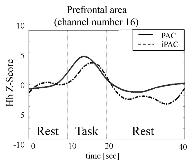 Figure 12: Oxy-Hb waveform from brain Prefrontal area.