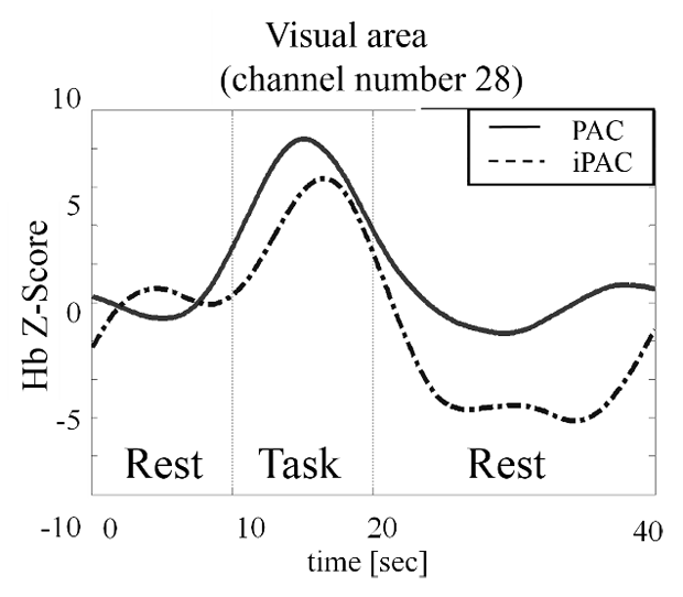 Figure 13: Oxy-Hb waveform from brain Visual area.