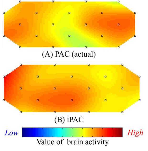 Figure 14: Brain activity image (prefrontal area).