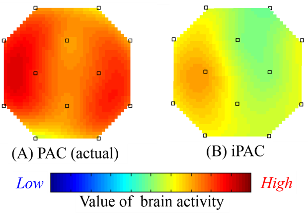 Figure 15: Brain activity image (visual area).