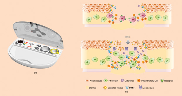 Figure 1: (a) Aviata Medical’s ReCell device creates what it calls RES from a patient’s skin sample. (b) Containing a mixture of skin cells and wound-healing factors from the patient, the RES can be sprayed onto a burn wound. (Images courtesy of Avita Medical.)