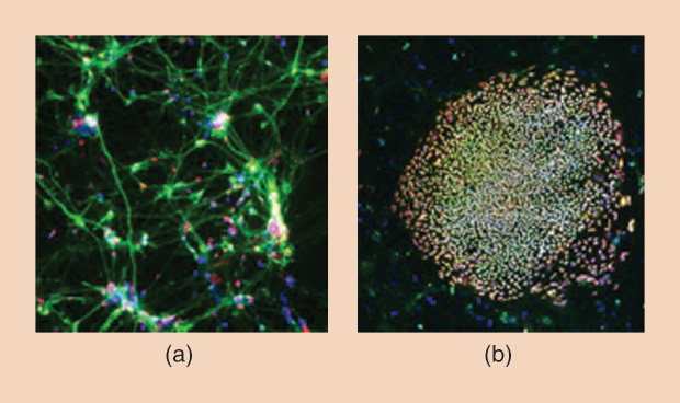 Dr. Jeanne Loring’s research group is one of many around the world considering disease therapies that utilize iPSCs. Her particular interest is in treatments for Parkinson’s disease, a progressive disorder that affects the nervous system and leads to movement problems. (a) iPSC-derived dopaminergic neurons in development for the Parkinson’s therapy and (b) undifferentiated human iPSCs that are labeled with antibodies to pluripotency biomarkers. (Images courtesy of Andres Bratt- Leal and the Scripps Research Institute.)