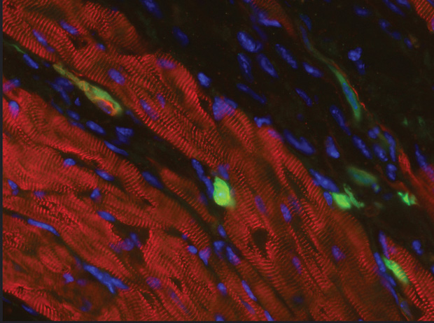 Figure 3: The cells in green are skin cells directly reprogrammed into heart muscle cells, which may one day be used to mend heart muscle damaged by disease or heart attack. (Image courtesy of the laboratory of Deepak Srivastava at the Gladstone Institute of Cardiovascular Disease.)