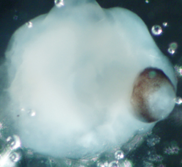Figure 4: A pea-sized brain organoid with the retina visible as a dark patch to the right. (Image courtesy of Madeline Lancaster/IMBA.)