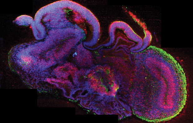 Figure 5: A thin slice of a brain organoid stained for different cell types reveals complex brain morphology under the microscope. (Image courtesy of Madeline Lancaster/IMBA.)