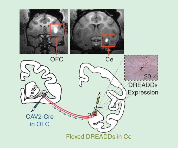 Figure 7: Targeting DREADDs to specific connections between the amygdala (Ce) and the orbitofrontal cortex (OFC), a region of the prefrontal cortex. Injections in each region identify the subset of neurons in the Ce that send inputs to the OFC. The DREADD construct is expressed only in this subset. (Images courtesy of Ned Kalin and Jonathan Oler.)