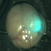 Figure 4: Through the use of tumor paint BLZ-100 and visualization with near-infrared light, a tumor in a mouse brain glows brightly. (The smaller white areas are simply light reflection.) Image courtesy of Blaze Bioscience, Inc.