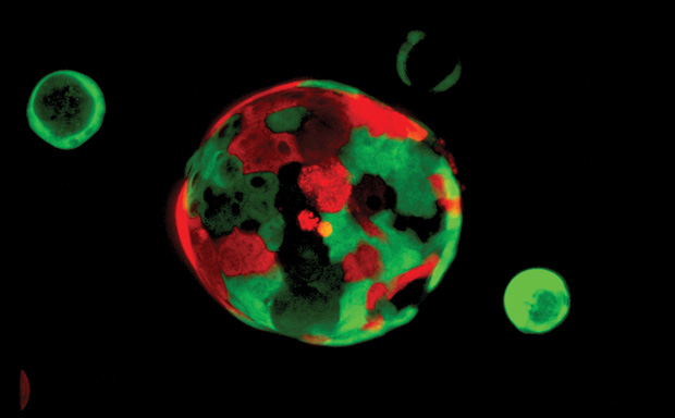Figure 5: Tuvenson’s research group is using organoids like these, which are about the size of the period at the end of this sentence, to study prostate cancer and potentially develop a new option for treating the disease. (Image courtesy of the Tuveson Laboratory at Cold Spring Harbor.)