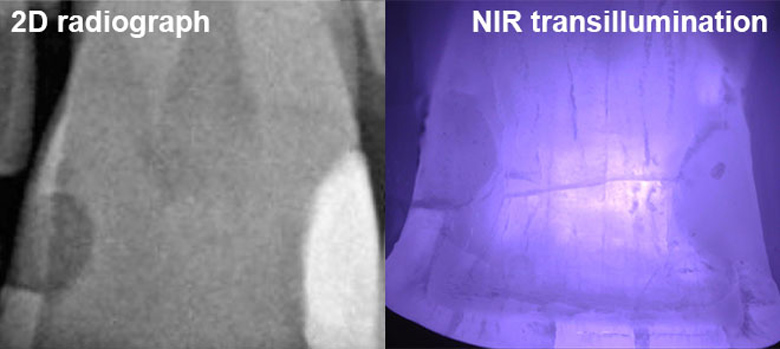 Near-Infrared Imaging for Detecting Caries and Structural Deformities in Teeth