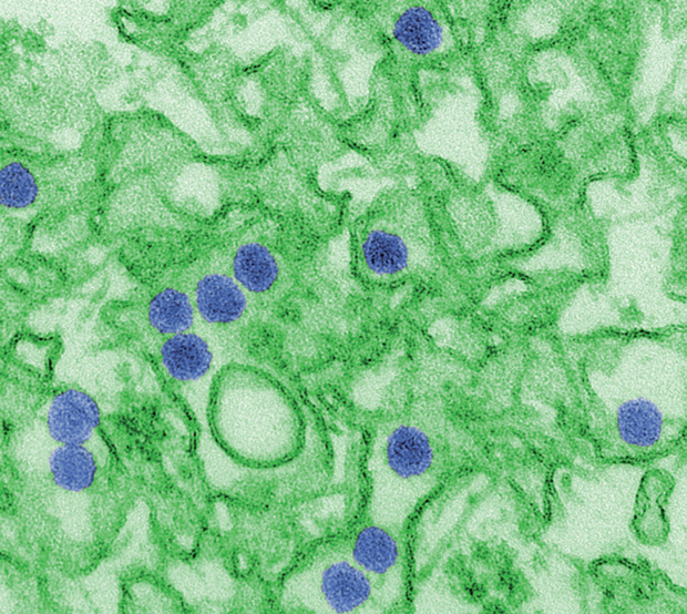 Figure 1: The Zika virus. (Image courtesy of Cynthia Goldsmith, Centers for Disease Control and Prevention.)