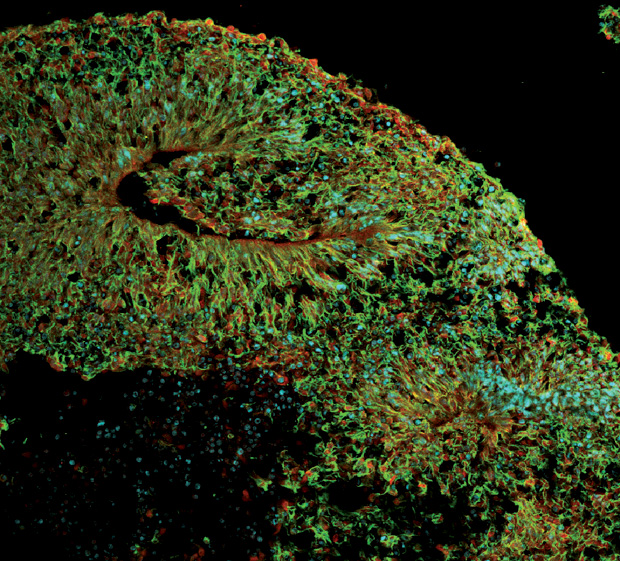 Figure 2: A brain organoid section, developed in Stevens Rehen’s lab. Neurons are stained green, neural stem cells are in red, and cell nuclei in blue. (Image courtesy of D’Or Institute for Research and Education, Rio de Janeiro/Stevens Rehen.)