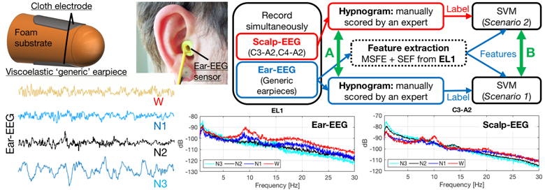 Automatic Sleep Monitoring Using Ear-EEG