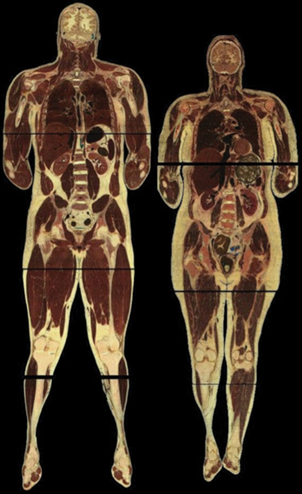 Figure 1: A reconstruction of the frontal section of the Visible Human male (left) and female shown to the same scale. (Photo courtesy of Victor Spitzer, University of Colorado, Denver.)