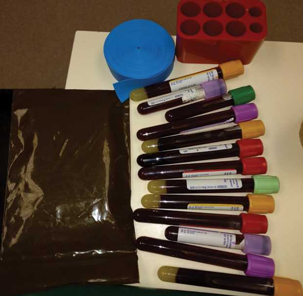 Figure 6: Larry Smarr’s quarterly blood draw, part of his self-tracking to understand his body’s dynamics. (Photo courtesy of Larry Smarr, Calit2.)