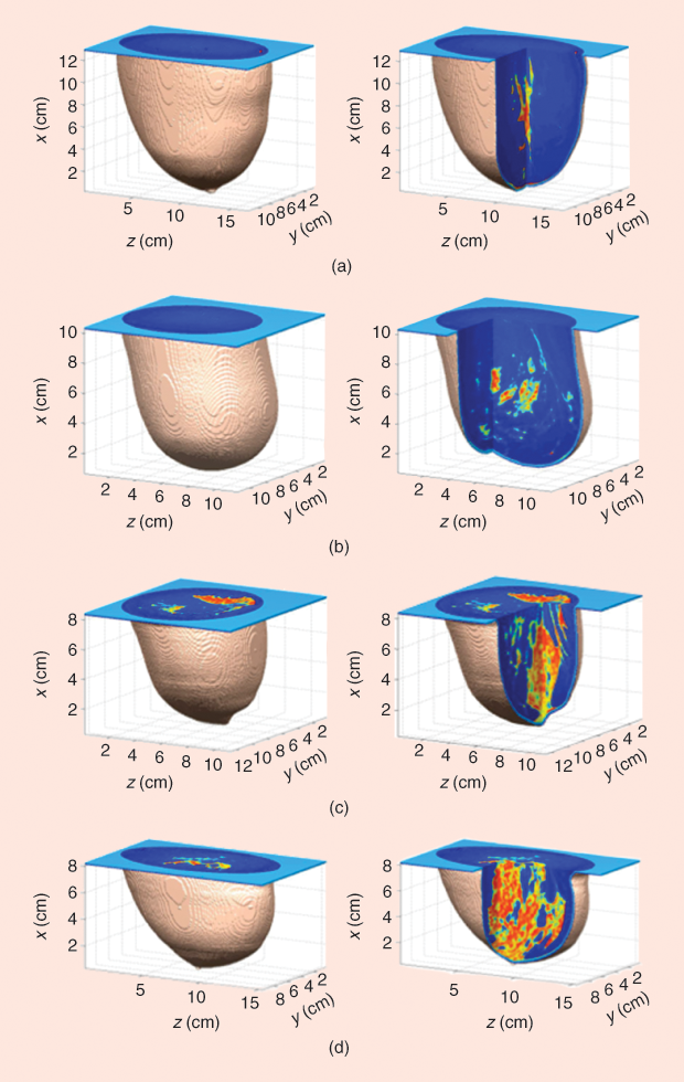 Figure 2: Representative numerical breast phantoms from the University of Wisconsin repository. The false color visualizations show the adipose (blue) and fibroglandular (red/orange) regions of the heterogeneous interior of the phantoms. The phantoms span the four American College of Radiology classes of breast density: (a) fatty, (b) scattered fibroglandular, (c) heterogeneously dense, and (d) extremely dense.
