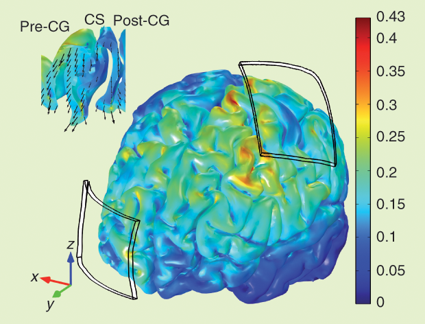 Figure 2: The magnitude of the electric field in the cortex during 1-mA tDCS. The upper left inset depicts the electric-field magnitude and direction in the central sulcus (CS) and in the post- and precentral gyrus (post/pre-CG). The scale is in V/m.