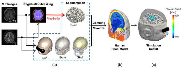 Figure 1. Schematic explanation of the procedure for developing (b) an anatomical human head model from (a) two kinds of magnetic resonance images and (c) an example of the computed internal electric field on the brain surface.