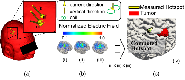 Figure 2. (a) Different positions and angles of the TMS coil are chosen to stimulate the brain to find which areas activate the target muscles (hotspot). (b) The induced electric field distribution is calculated by the electromagnetic software using individualized models for each TMS coil position and angle. The maximum values of the electric field induced in the brain indicate the region where the brain is mostly activated. To pinpoint the hotspot, the induced electric fields that generated the highest muscle responses were selected and multiplied. (c) The estimated hotspot of the hand motor area is shown (M1). (Courtesy of Drs. Yoshihiro Muragaki, Manabu Tamura, and Tomokazu Takakura for measured data).