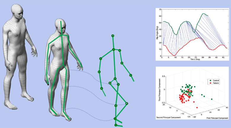 A Microsoft Kinect-Based Point-of-Care Gait Assessment Framework for Multiple Sclerosis Patients