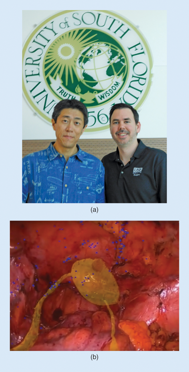 Figure 6: (a) Dr. Yu Sun (left) and Dr. Jaime Sanchez (right), of the USF Morsani College of Medicine. (b) A screen shot of the USF system’s laparoscopic image, looking into the pelvis with an overlay of the urinary bladder and ureters in yellow. The blue dots are overlays of the unique feature points its algorithm uses to maintain the image in real-time registration.