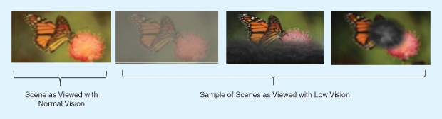 Figure 1: A depiction of scenes as viewed with normal vision (left) versus low vision. (Images courtesy of the Chicago Lighthouse.)