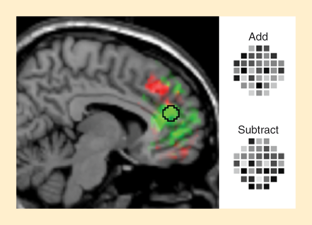 Figure 5: Haynes’ research shows that it is possible to determine a subject’s intentions—in this case, whether the person was preparing to perform an addition or a subtraction—by reading brain-activity patterns. Activity patterns in the green regions predicted covert intentions before the subject began to perform the calculation. The regions marked in red revealed intentions that were already being acted upon. (Photo courtesy of Bernstein Center for Computational Neuroscience.)