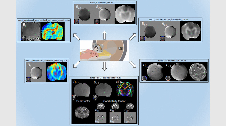 Software Toolbox for Low-frequency Conductivity and Current Density Imaging using MRI