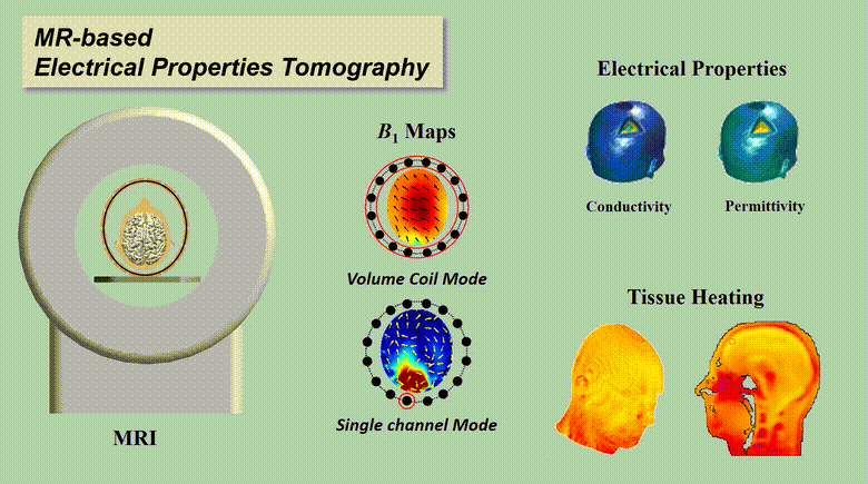 Electrical Properties Tomography Based on B1 Maps in MRI: Principles, Applications, and Challenges