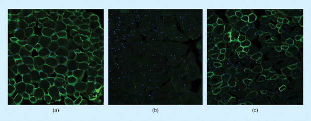 Images highlighting the differences in dystrophin expression. The dystrophin protein is labeled bright green. (a) A cross section of normal, healthy muscle tissue. (b) Tissue from a mouse model of DMD before being treated with the CRISPR gene-editing system and (c) after treatment. (Photo courtesy of Christopher Nelson.)