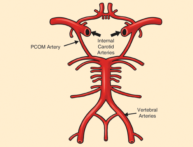 Figure 1: A schematic of the CW. The internal carotids and the vertebral arteries are somewhat similar to the feeder stations S1–S4 in ring arrangement power distribution systems (see Figure 4). The thick black arrows point to the two carotid arteries coming from below; they are the main feeders to the brain. After crossing the circle, and on both sides, they continue as the middle cerebral arteries, left and right. It is the same with the two vertebrals, although less important. (The figure has been simplified by the authors and redrawn by Gustavo Idemi.)