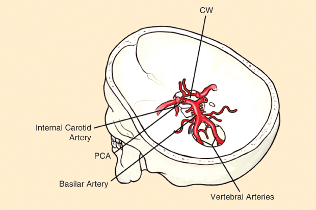 Figure 3: A schematic drawing of the CW horizontally depicted inside the skull. The left internal carotid is barely seen, while the two vertebrals appear more evident. The circle is also well marked. (The figure has been redrawn and modified by Gustavo Idemi.)